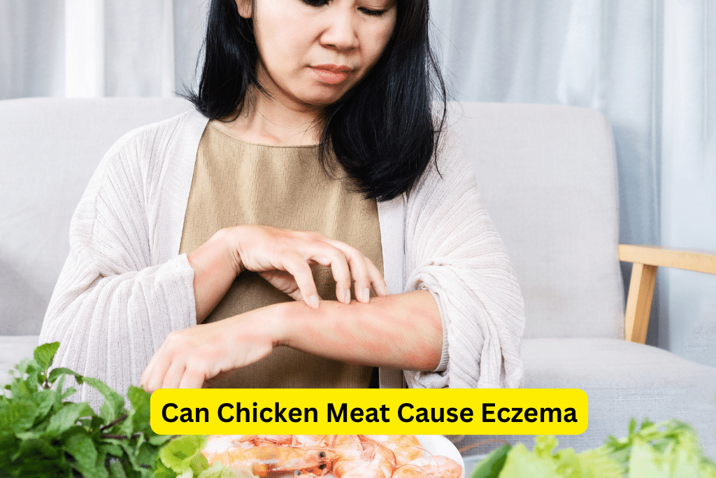 Can Chicken Meat Trigger Eczema? Link and Prevention Strategies Can