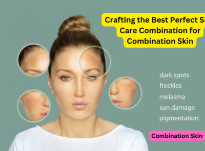 Crafting the Best Perfect Skin Care Combination for Combination Skin