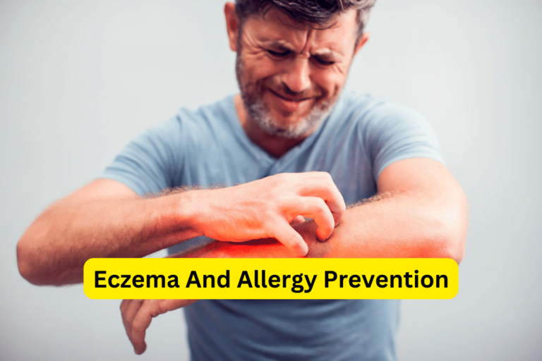 Prevent Eczema and Allergies: Expert Tips and Natural Remedies 