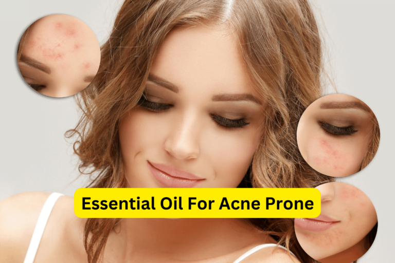 Clear Acne with Essential Oils – Find the Perfect Remedy Now! 