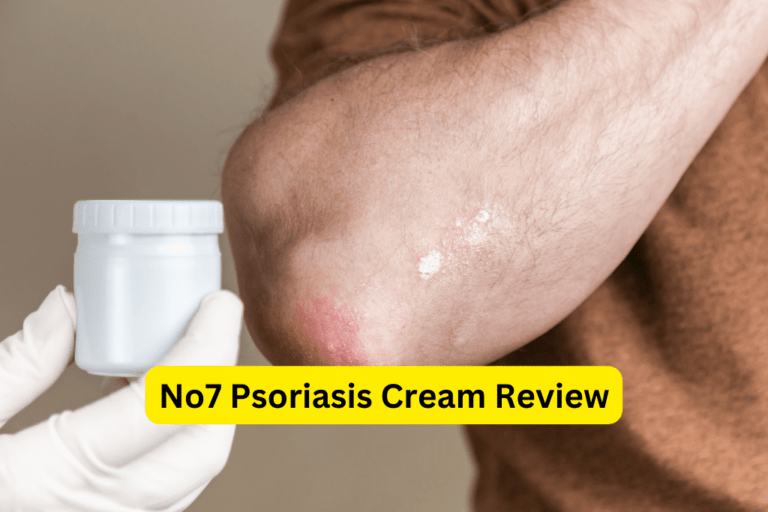 No7 Psoriasis Cream: The Ultimate Solution? Review