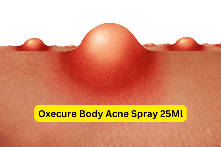 Conquer Acne Today – Experience Results with Oxecure’s Body Spray