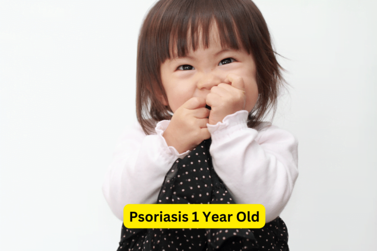 Managing Psoriasis in One-Year-Olds: A Comprehensive Guide