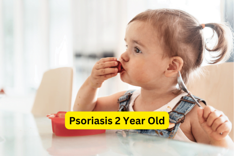 Treating Psoriasis in 2-Year-Olds: Effective Care Tips 