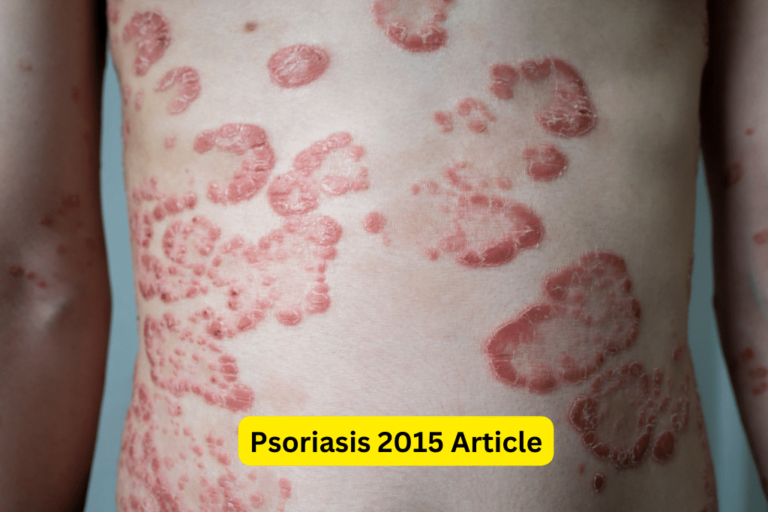 Psoriasis Uncovered: Effective Treatments and New Discoveries 