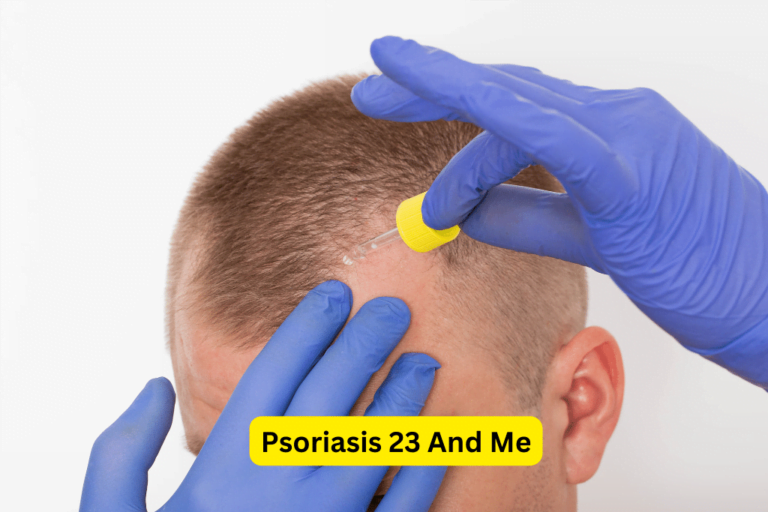 23andMe: Genetic Insights and Personalized Solutions for Psoriasis 