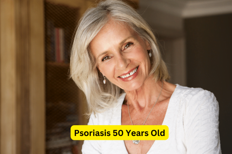 Managing Psoriasis at 50: Effective Treatment Options for Over 50s