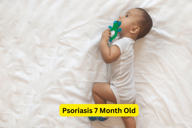 Psoriasis in 7-Month-Olds: Causes, Symptoms, and Treatment