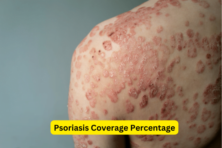Latest Psoriasis Coverage Percentages: What You Need to Know 