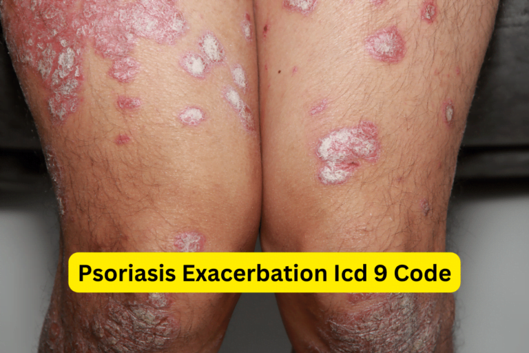 Expert Tips to Manage Psoriasis Exacerbation: Effective Solutions