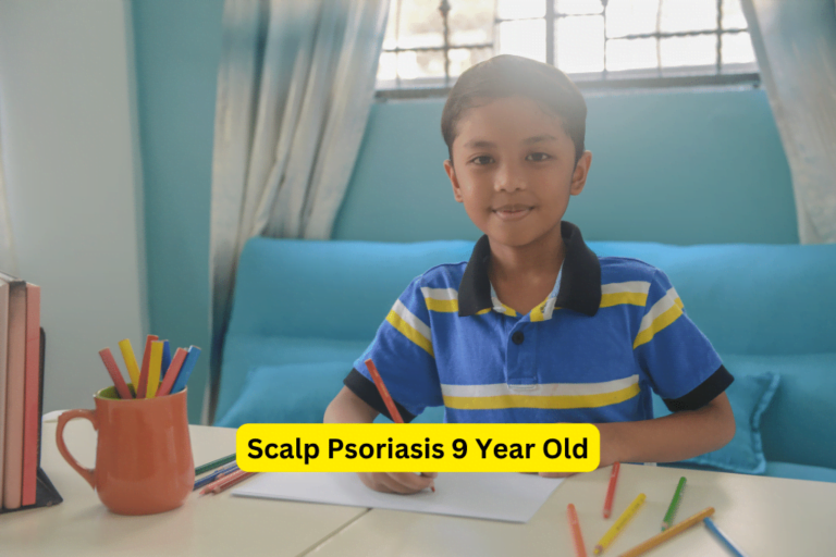 Managing Scalp Psoriasis in 9-Year-Olds: Empowering Parents 