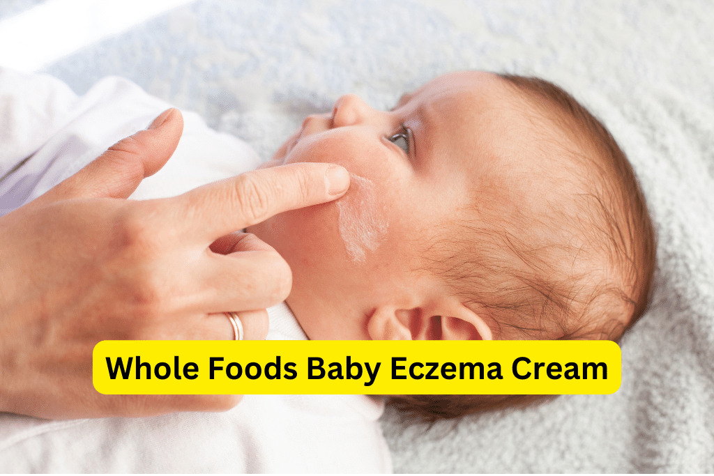 Natural Relief for Baby Eczema: Whole Foods Baby Eczema Cream - Whole ...